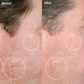 Personal Microderm Elite Pro - Black
