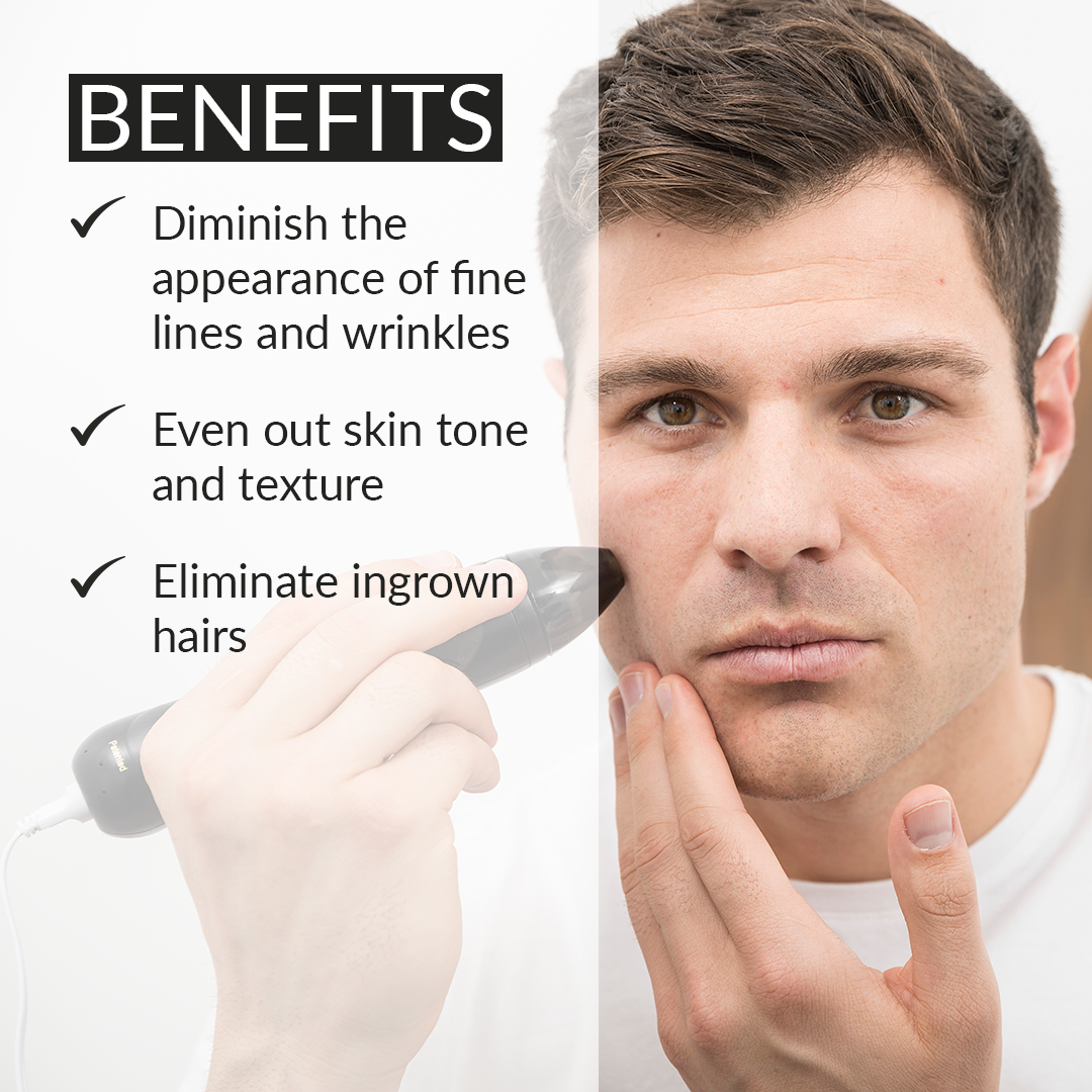 Personal Microderm Pro - Black